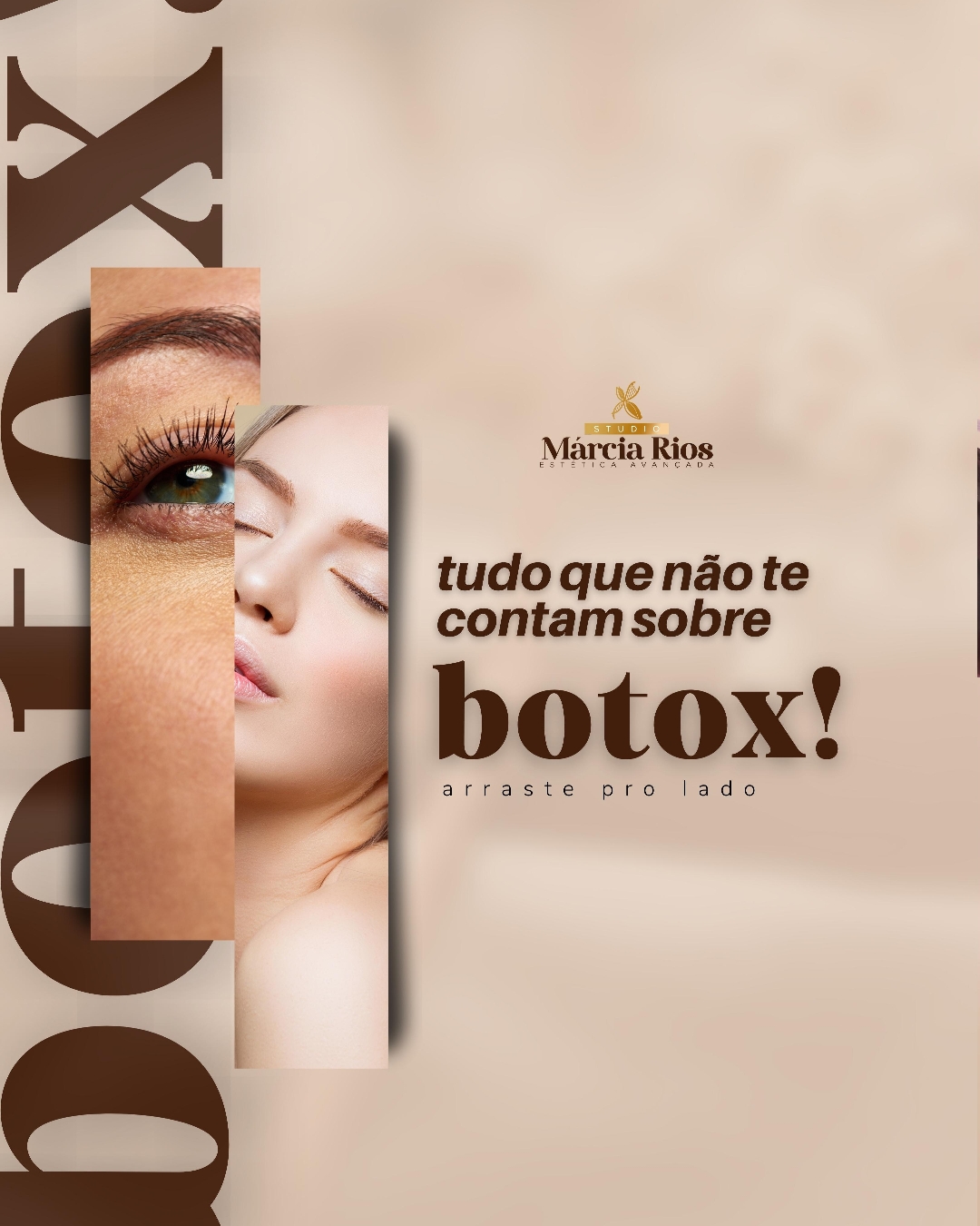 Tudo Que N O Te Contam Sobre Botox Studio M Rcia Rios